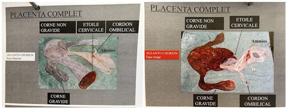 examen du placenta